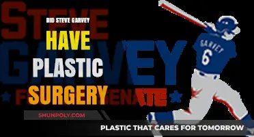 Steve Garvey's Transformation: Plastic Surgery Rumors Explored and Debunked