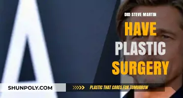 Steve Martin's Transformation: Plastic Surgery Rumors Explored and Debunked