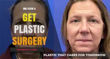 Steve-O's Transformation: Plastic Surgery Rumors and Reality Revealed