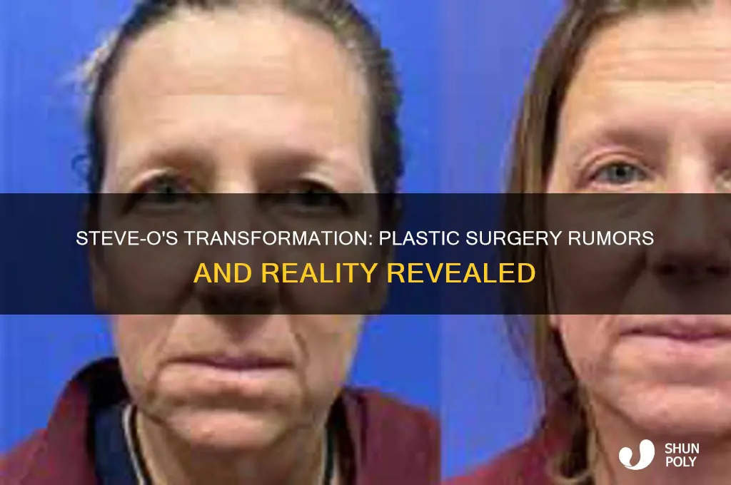 did steve o get plastic surgery