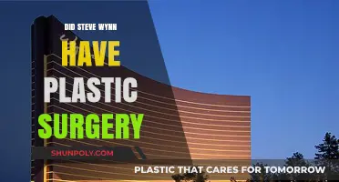 Steve Wynn's Transformation: Unveiling the Truth About His Plastic Surgery