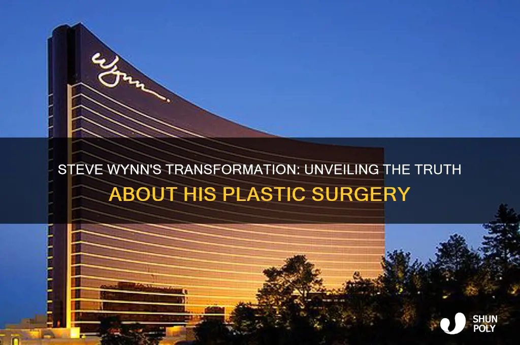 did steve wynn have plastic surgery