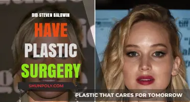 Did Stephen Baldwin Undergo Plastic Surgery? Unveiling the Truth