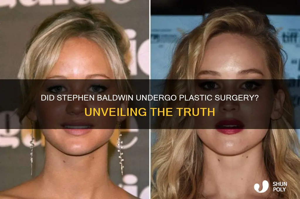 did steven baldwin have plastic surgery