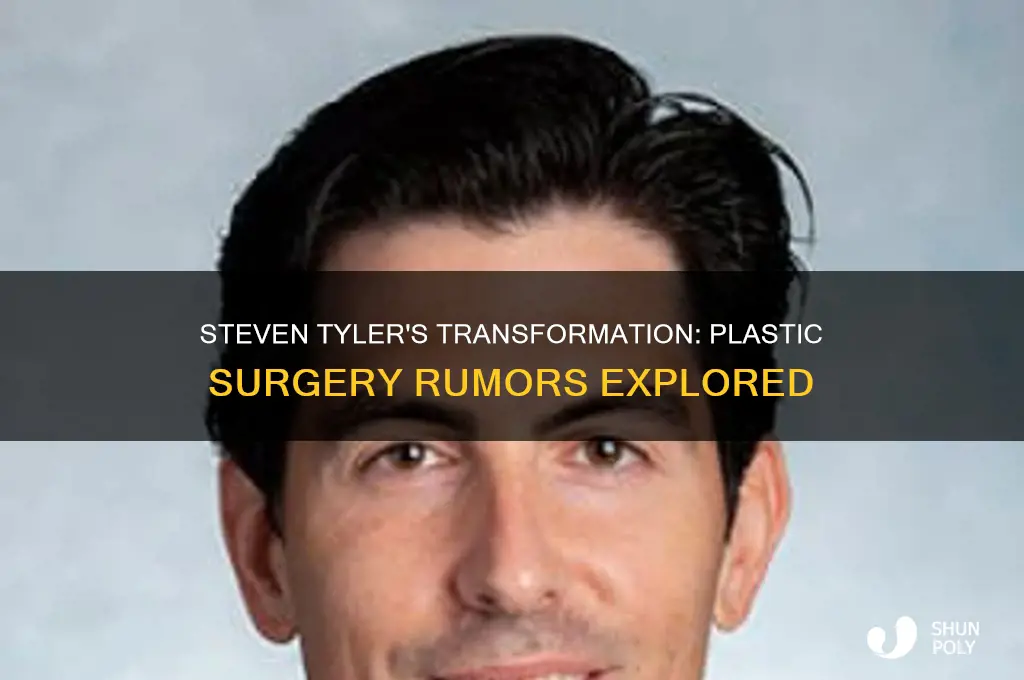 did steven tyler get plastic surgery