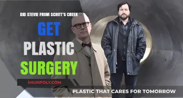 Stevie Budd's Transformation: Plastic Surgery Rumors in Schitt's Creek