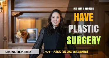 Stevie Wonder's Transformation: Plastic Surgery Speculations and Facts Revealed