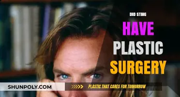 Sting's Youthful Look: Plastic Surgery Rumors Explored and Debunked