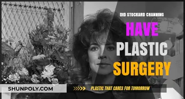 Stockard Channing's Transformation: Plastic Surgery Rumors Explored