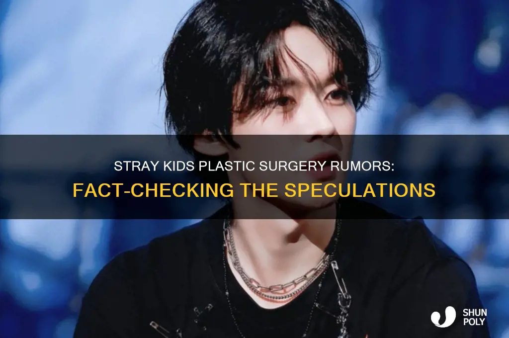 did stray kids get plastic surgery