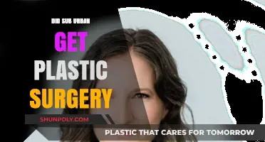 Did Sub Urban Undergo Plastic Surgery? Unraveling the Truth