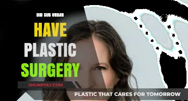 Did Sub Urban Undergo Plastic Surgery? Unveiling the Truth