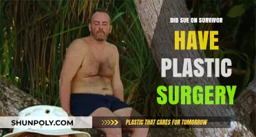 Did Sue Hawk from Survivor Undergo Plastic Surgery? The Truth Revealed