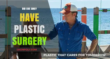 Sue Smey's Transformation: Plastic Surgery Rumors Explored and Debunked