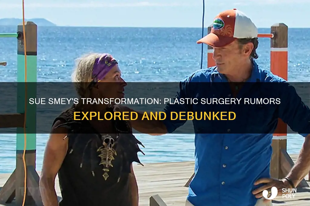 did sue smey have plastic surgery