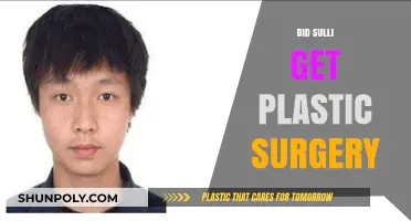 Sulli's Transformation: Unveiling the Truth About Her Plastic Surgery Rumors