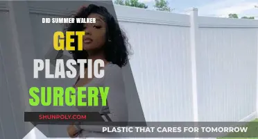 Did Summer Walker Undergo Plastic Surgery? Unveiling the Truth