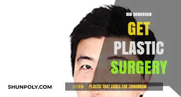 Did Sunghoon Undergo Plastic Surgery? Unveiling the Truth Behind the Rumors