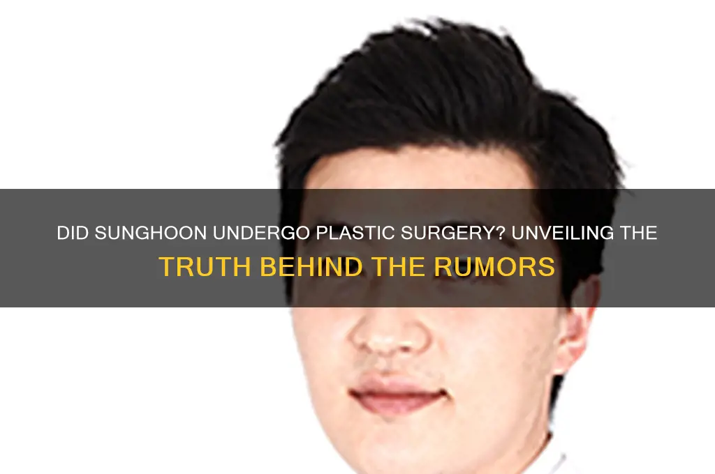 did sunghoon get plastic surgery