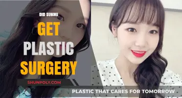 Sunmi's Transformation: Plastic Surgery Rumors and the Truth Behind Them