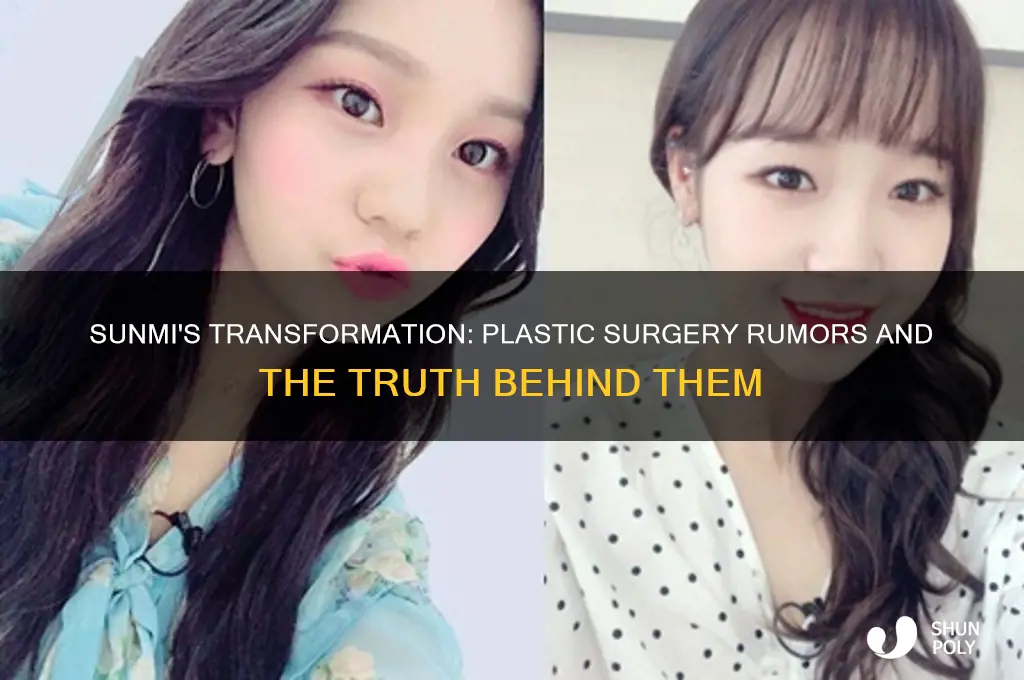 did sunmi get plastic surgery