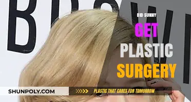Sunny's Transformation: Unveiling the Truth About Plastic Surgery Rumors