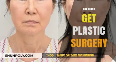 Sunoo Plastic Surgery Rumors: Fact-Checking the K-Pop Idol's Transformation