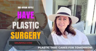 Susan Boyle's Transformation: Plastic Surgery Rumors and Reality Revealed