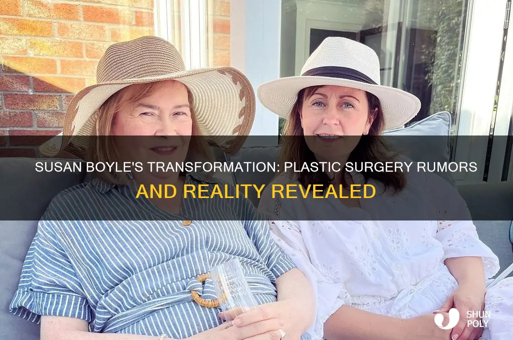 did susan boyle have plastic surgery