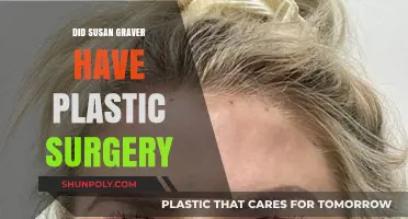 Susan Graver Plastic Surgery: Fact or Fiction? Unveiling the Truth
