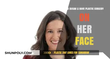 Susan Li's Facial Transformation: Plastic Surgery Speculations Explored