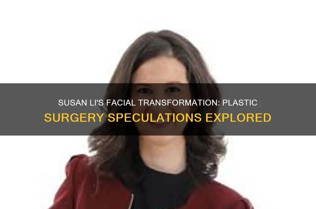 did susan li have plastic surgery on her face