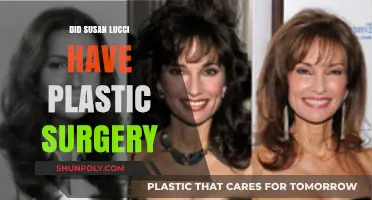 Susan Lucci's Transformation: Plastic Surgery Rumors and Reality Revealed