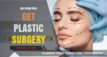 Susan Page Plastic Surgery: Fact-Checking the Rumors and Speculations
