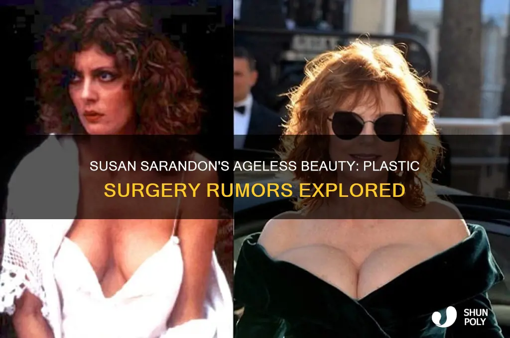 did susan sarandon have plastic surgery