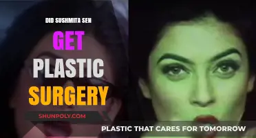 Sushmita Sen's Transformation: Plastic Surgery Rumors Explored