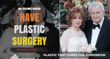 Suzanne Rogers Plastic Surgery: Fact-Checking the Rumors and Speculations