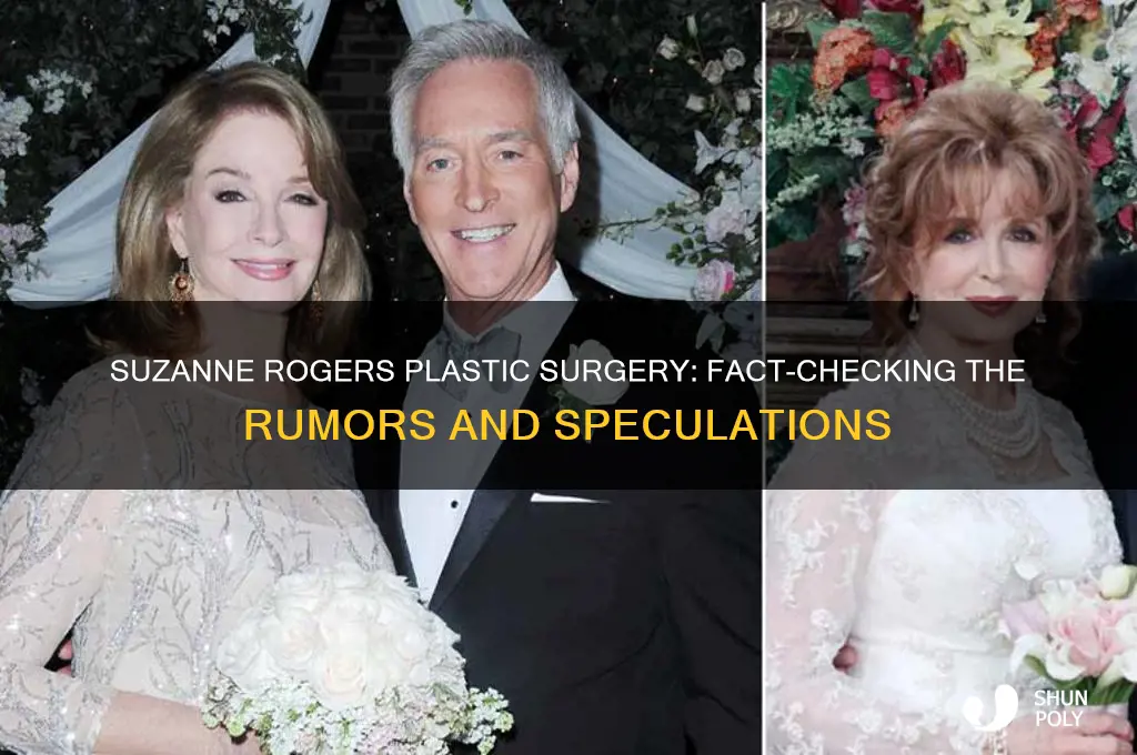 did suzanne rogers have plastic surgery
