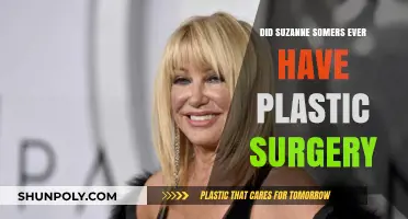 Suzanne Somers Plastic Surgery: Fact-Checking the Rumors and Speculations