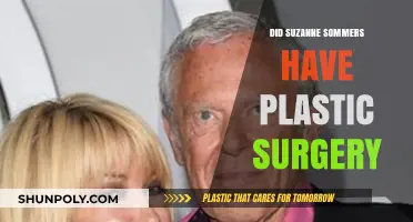 Suzanne Somers' Transformation: Plastic Surgery Speculations and Truths Revealed