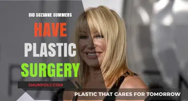 Suzanne Somers Plastic Surgery: Fact-Checking the Rumors and Speculations