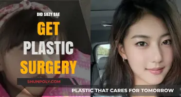 Suzy Bae's Transformation: Plastic Surgery Rumors and Reality Explored