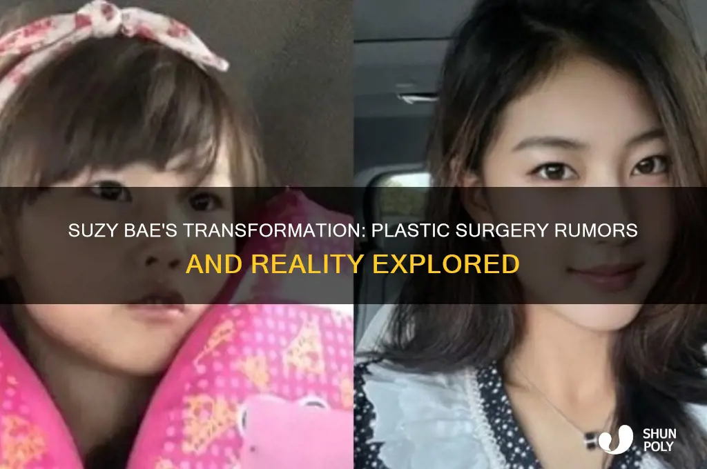 did suzy bae get plastic surgery