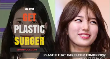 Did Suzy Undergo Plastic Surgery? Unveiling the Truth and Speculations