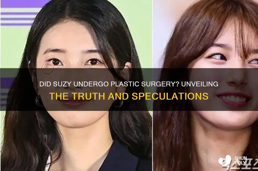 did suzy get plastic surger
