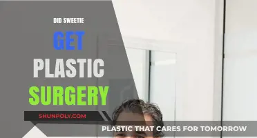 Did Sweetie Undergo Plastic Surgery? Unraveling the Transformation Truth