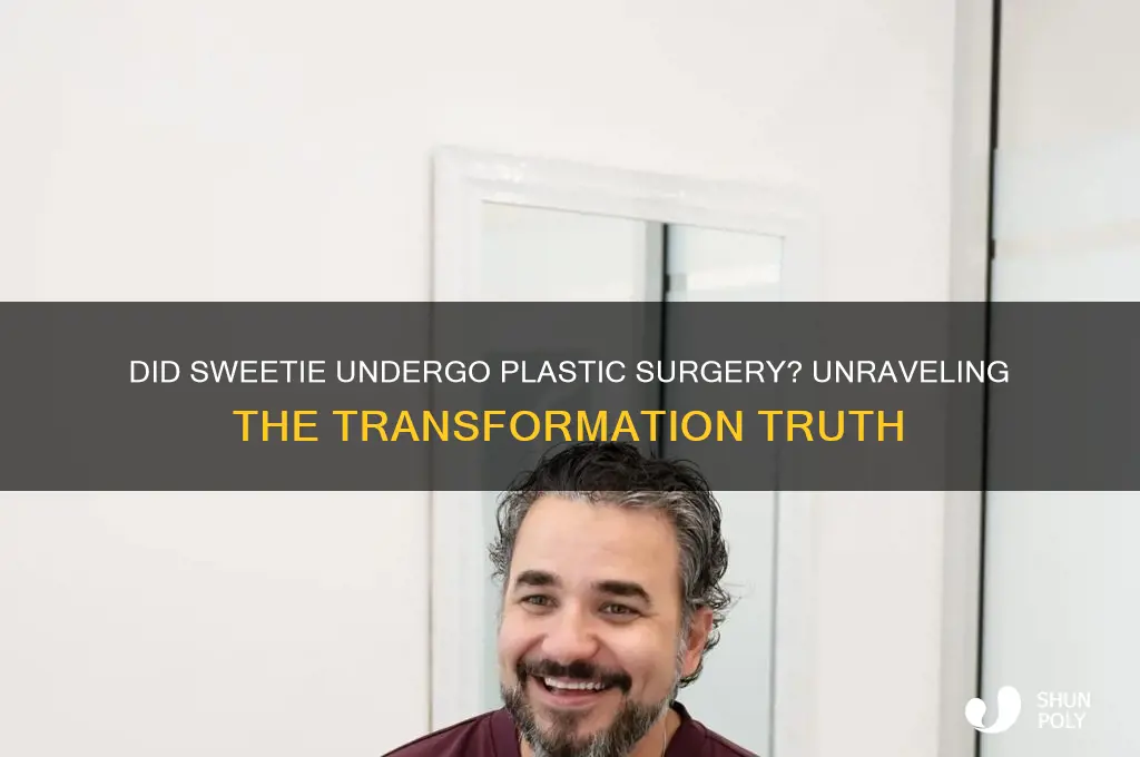 did sweetie get plastic surgery