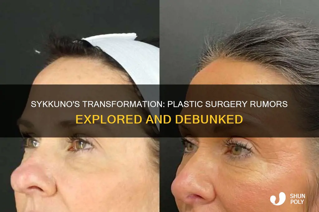 did sykkuno get plastic surgery