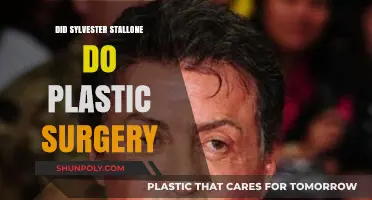 Sylvester Stallone's Transformation: Plastic Surgery Rumors Explored
