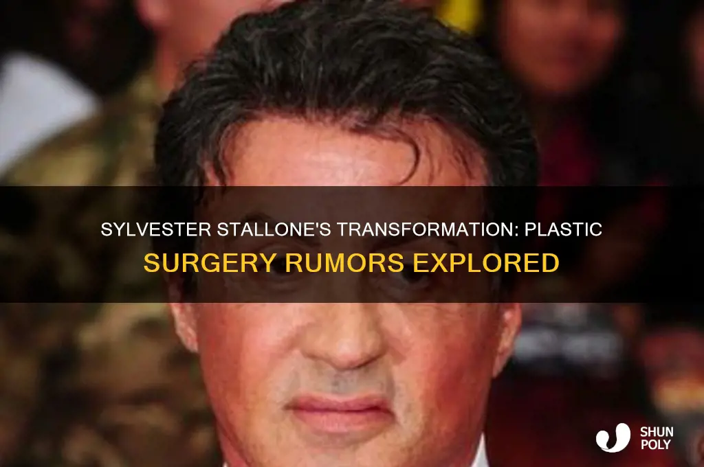 did sylvester stallone do plastic surgery